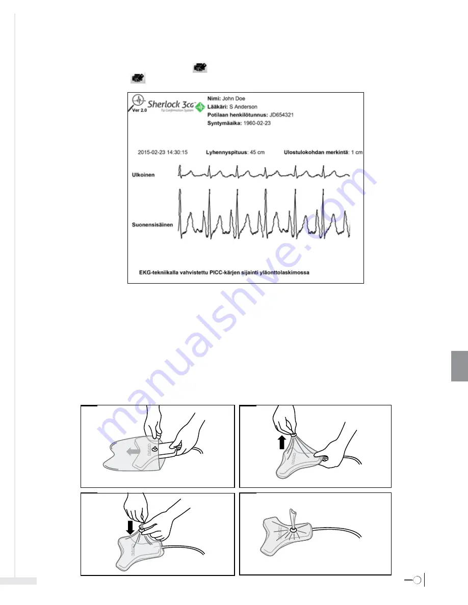 Bard Sherlock 3CG Instructions For Use Manual Download Page 291