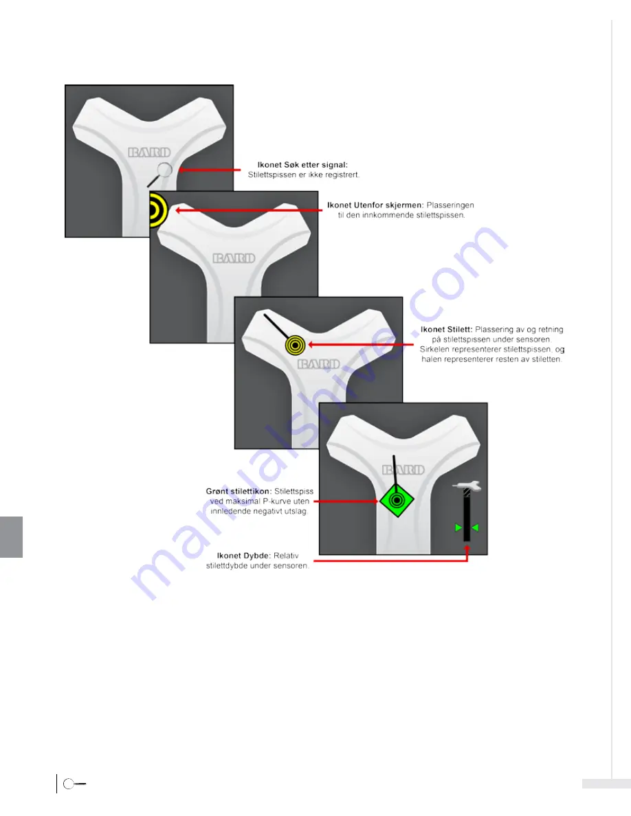 Bard Sherlock 3CG Instructions For Use Manual Download Page 308