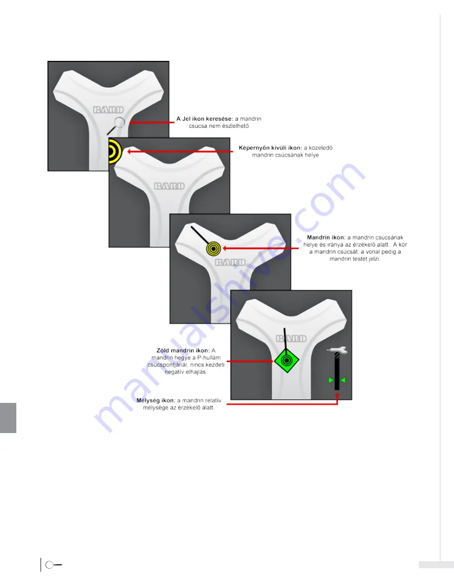 Bard Sherlock 3CG Instructions For Use Manual Download Page 334