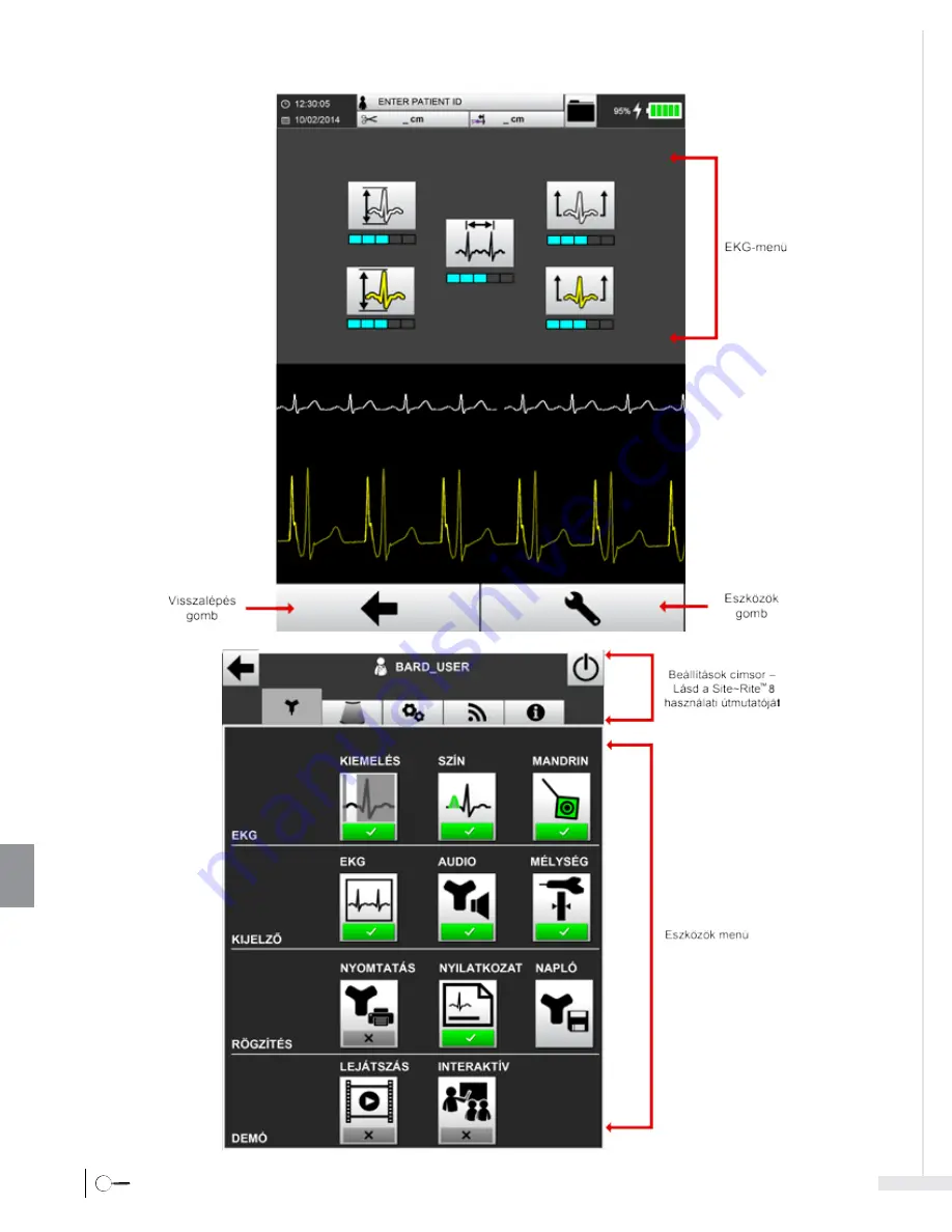 Bard Sherlock 3CG Instructions For Use Manual Download Page 336