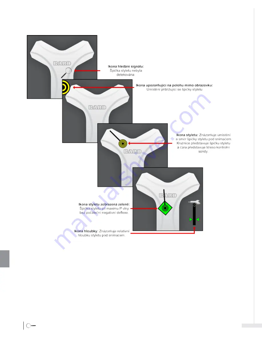 Bard Sherlock 3CG Instructions For Use Manual Download Page 360