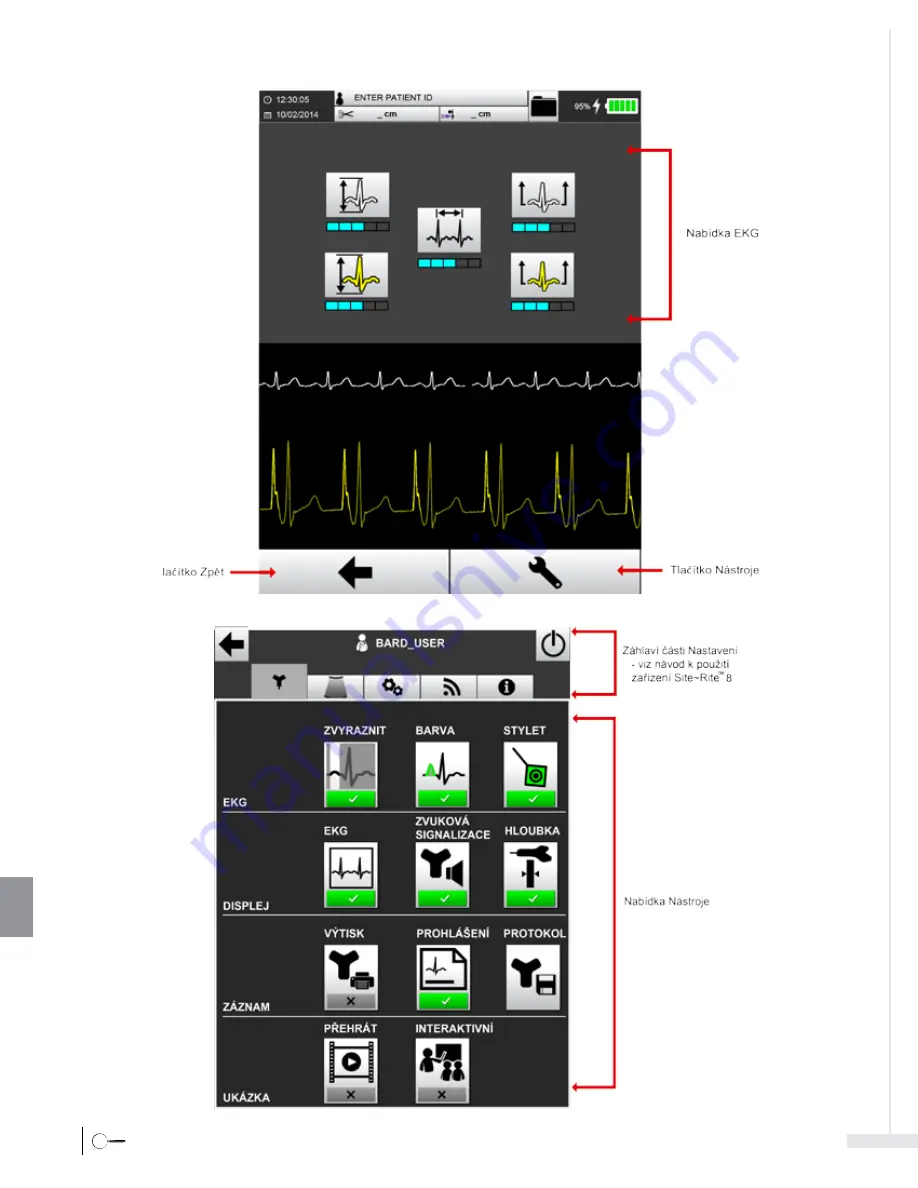 Bard Sherlock 3CG Instructions For Use Manual Download Page 362