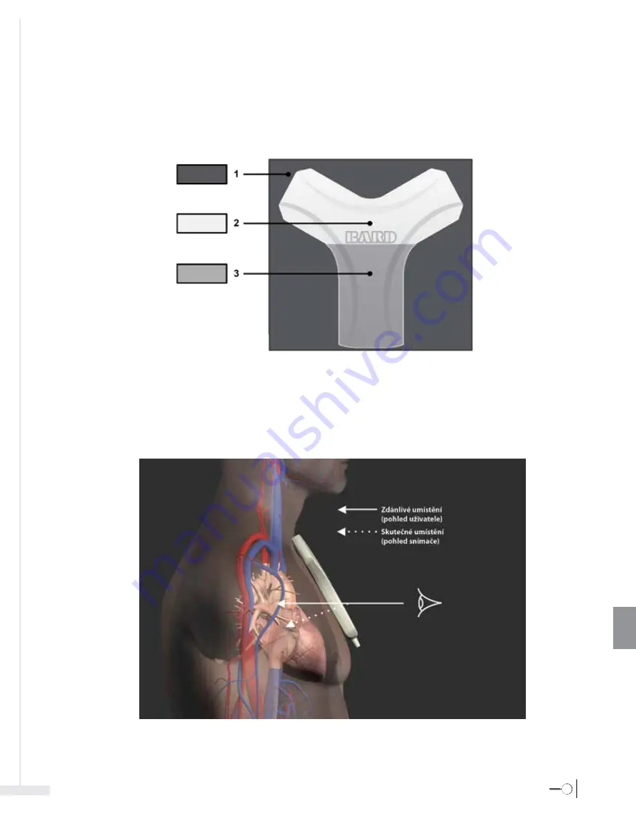 Bard Sherlock 3CG Instructions For Use Manual Download Page 365