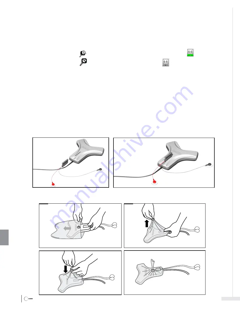 Bard Sherlock 3CG Instructions For Use Manual Download Page 366