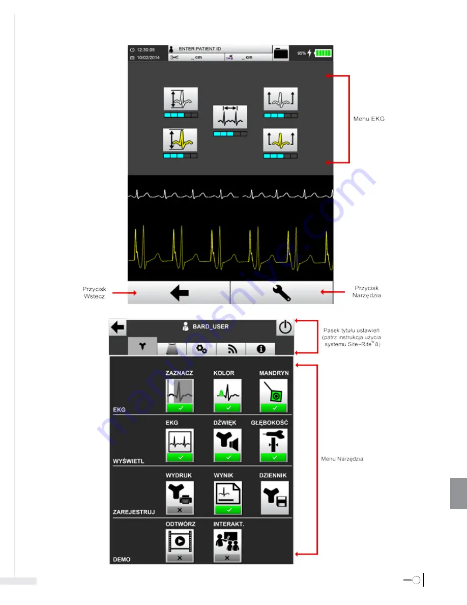 Bard Sherlock 3CG Instructions For Use Manual Download Page 389