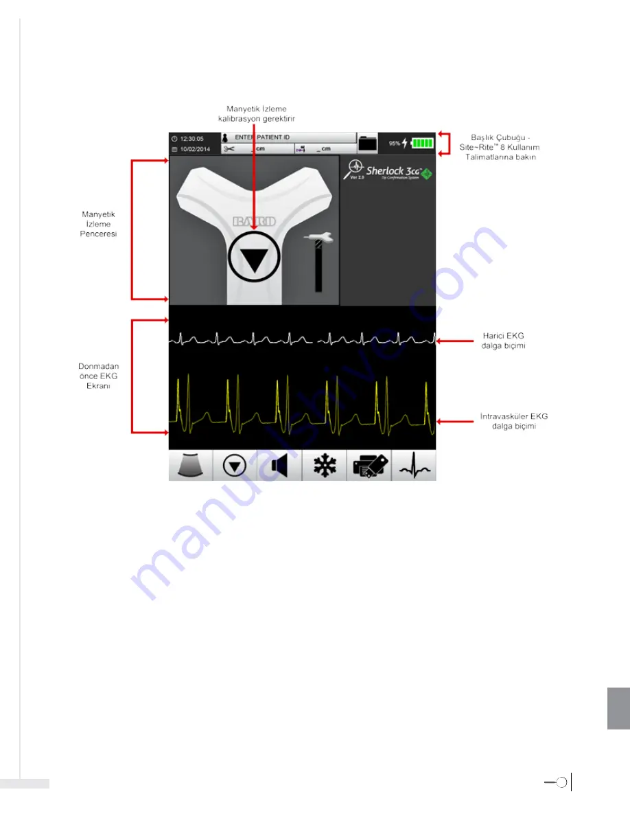 Bard Sherlock 3CG Instructions For Use Manual Download Page 413