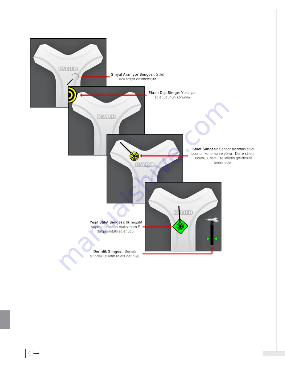 Bard Sherlock 3CG Instructions For Use Manual Download Page 414