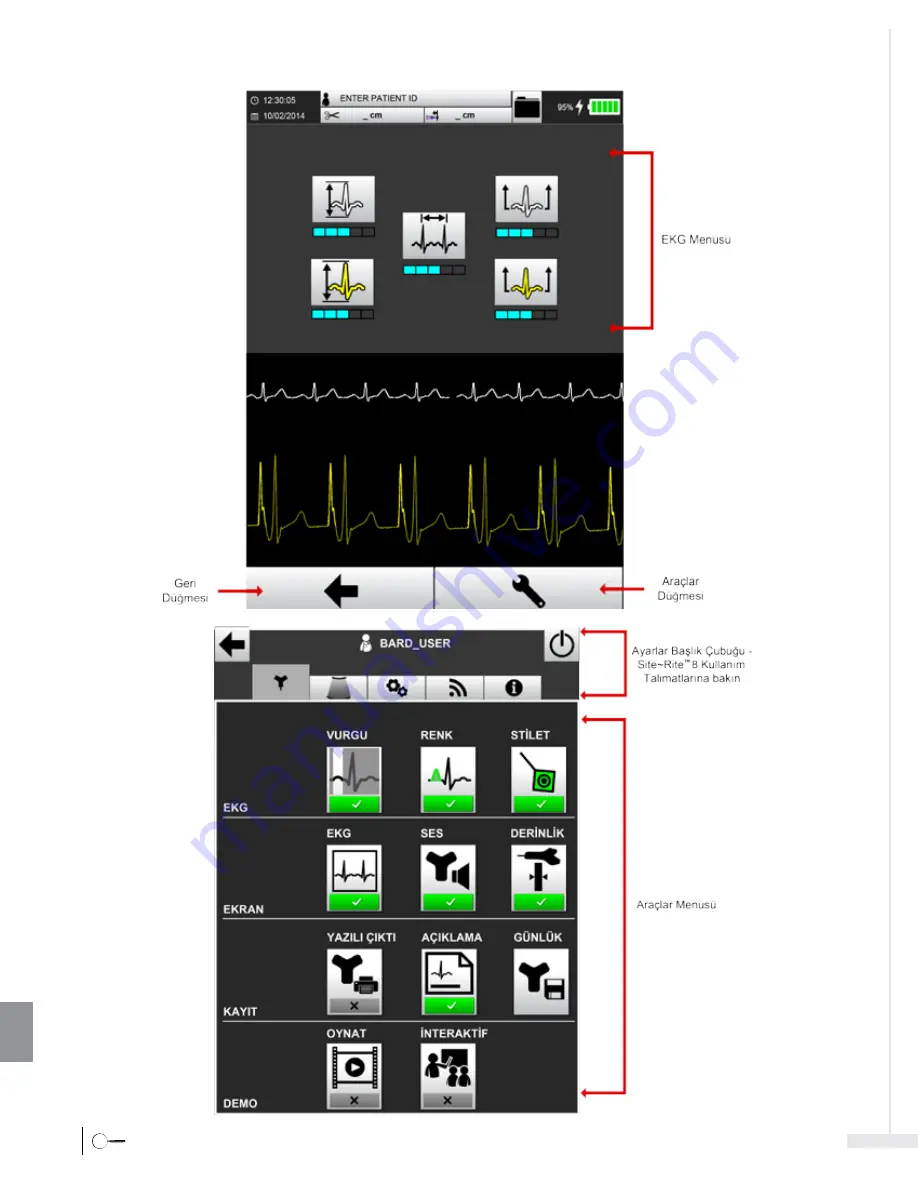 Bard Sherlock 3CG Instructions For Use Manual Download Page 416