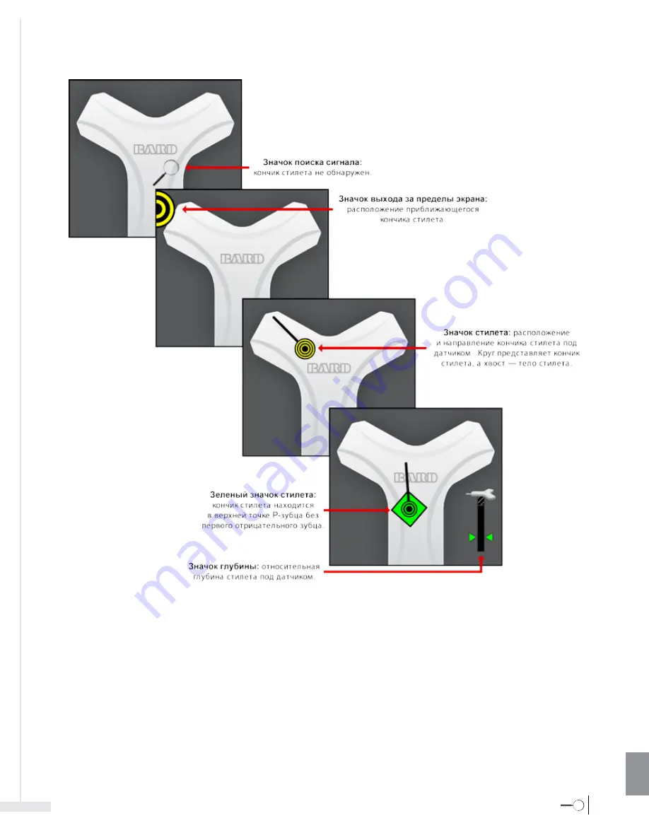 Bard Sherlock 3CG Instructions For Use Manual Download Page 441