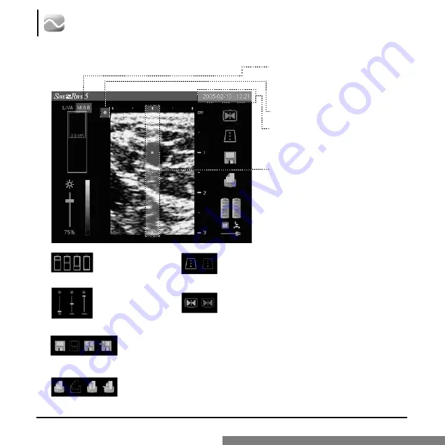 Bard Site-Rite 5 Скачать руководство пользователя страница 25