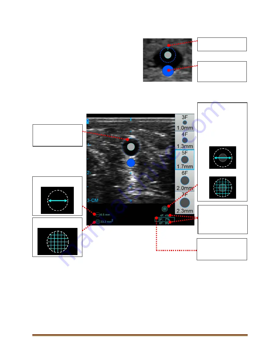 Bard Site-Rite 8 Скачать руководство пользователя страница 24