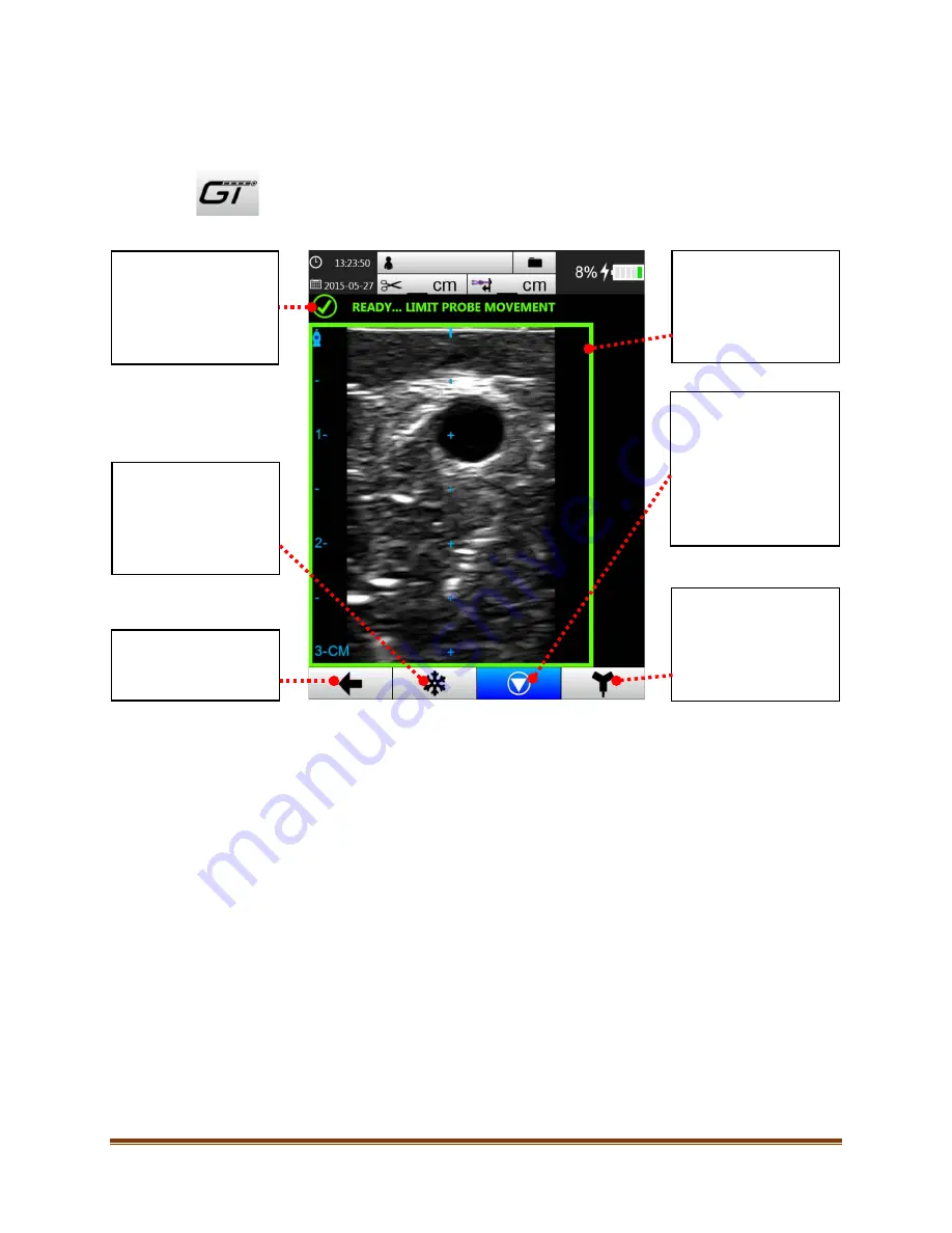 Bard Site-Rite 8 Скачать руководство пользователя страница 32