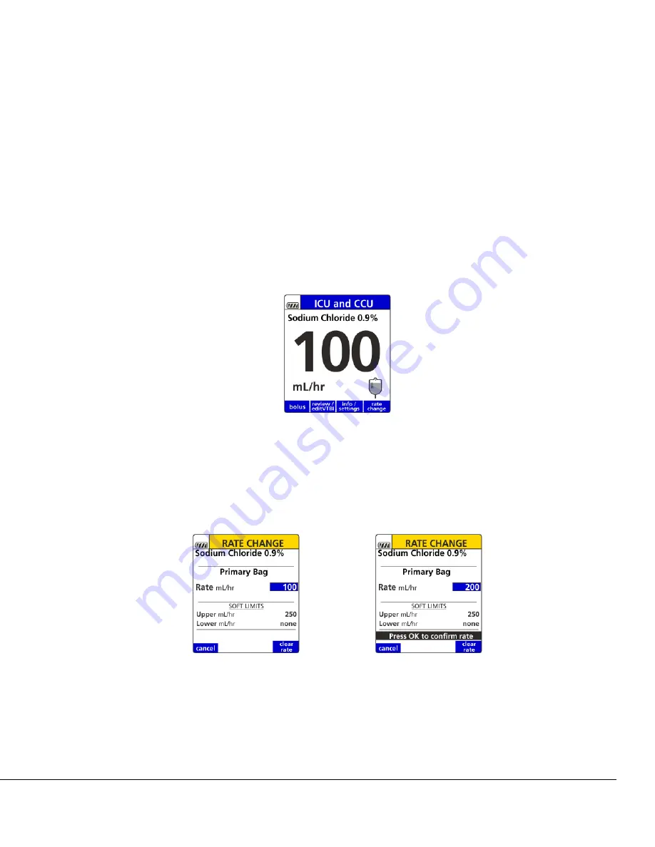 baxter 35700BAX2 Operator'S Manual Download Page 83