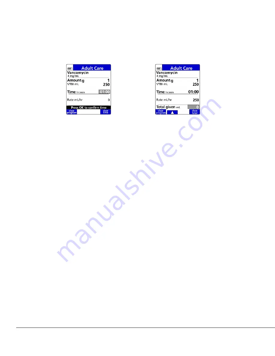 baxter 35700BAX2 Operator'S Manual Download Page 90