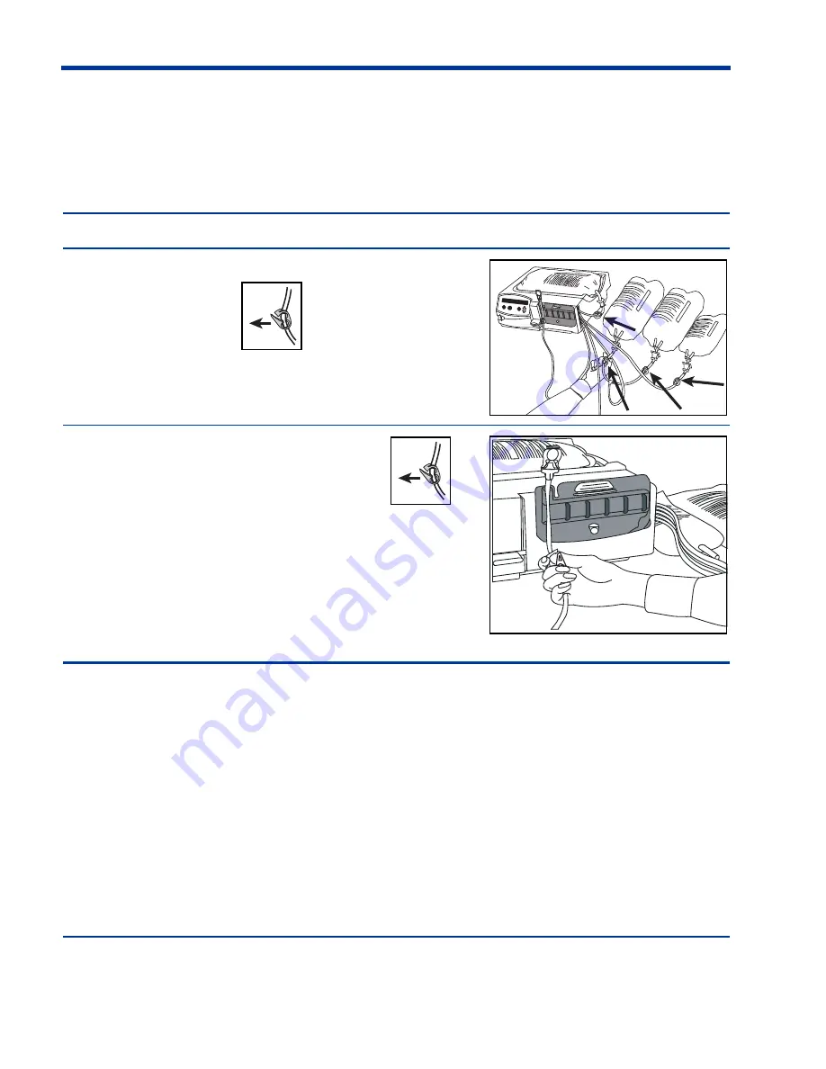 baxter HomeChoice Manual Download Page 192