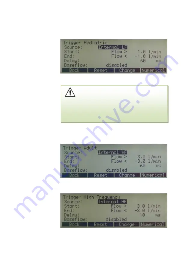 BC Biomedical PFC-3000 SERIES Скачать руководство пользователя страница 46