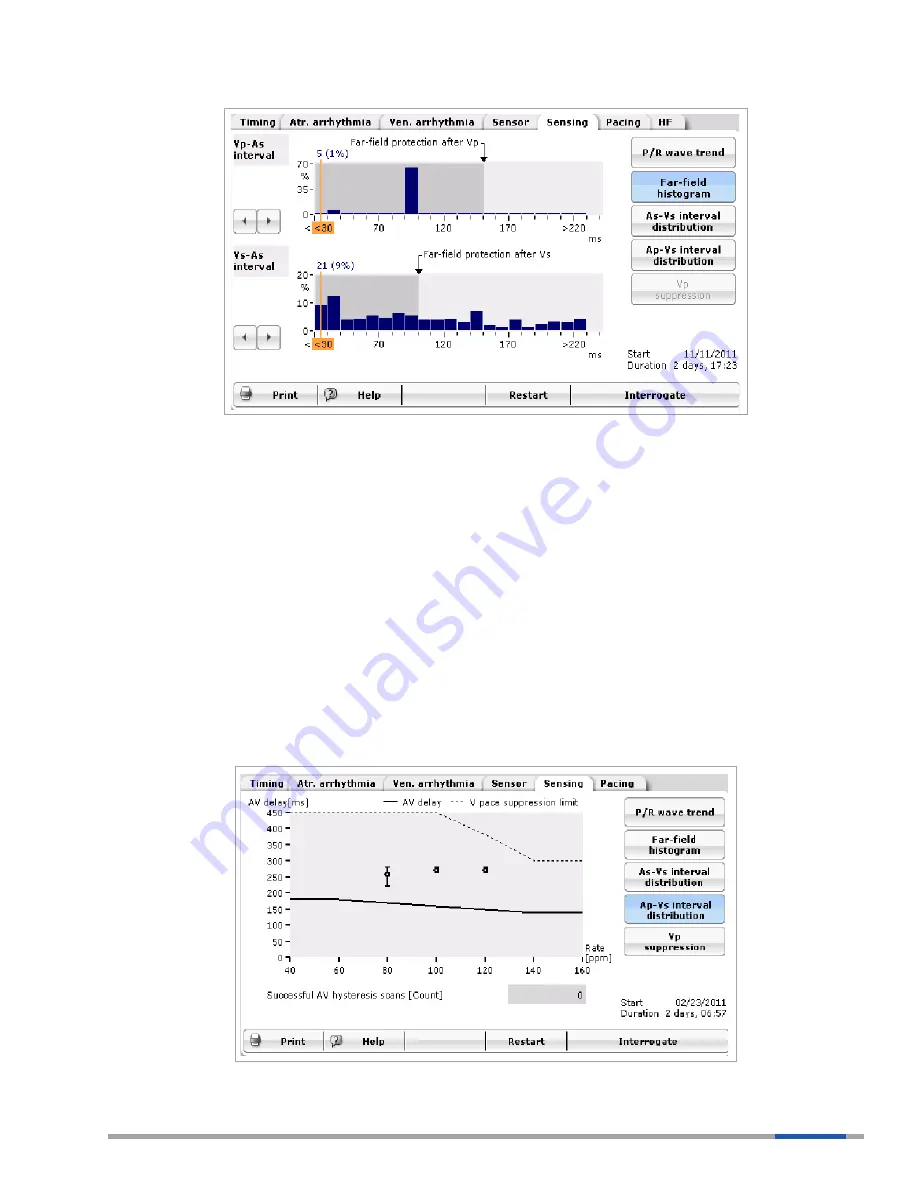 BIOTRONIK Evia HF Technical Manual Download Page 89