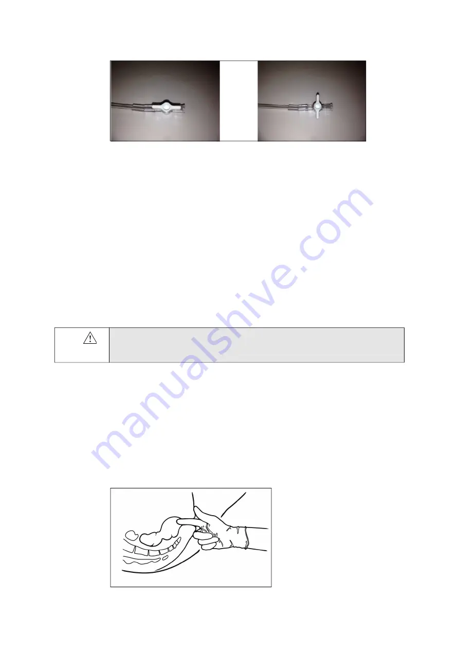 BK Medical 20R3 User Manual Download Page 18