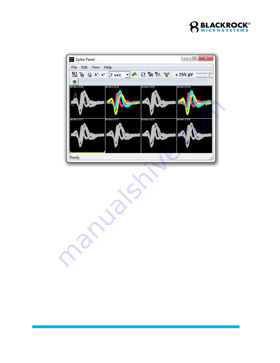 Blackrock Microsystems NeuroPort Instructions For Use Manual Download Page 67