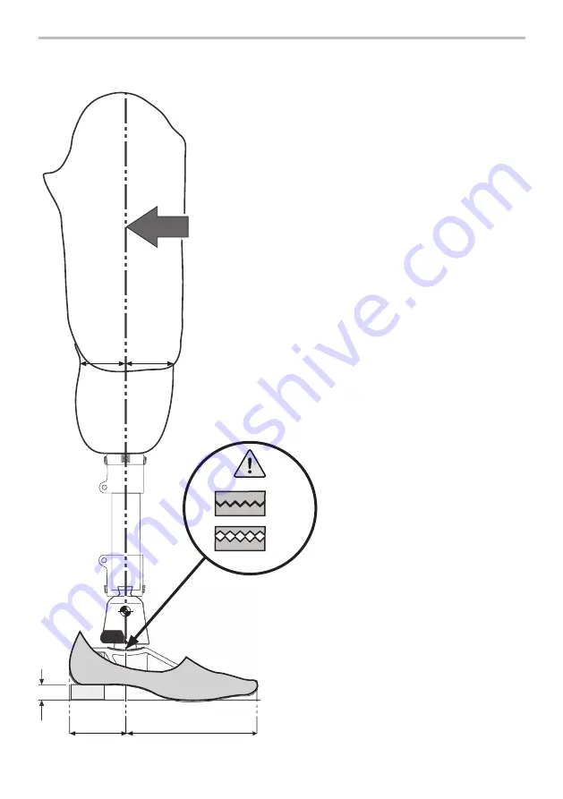 Blatchford 519119 Скачать руководство пользователя страница 28