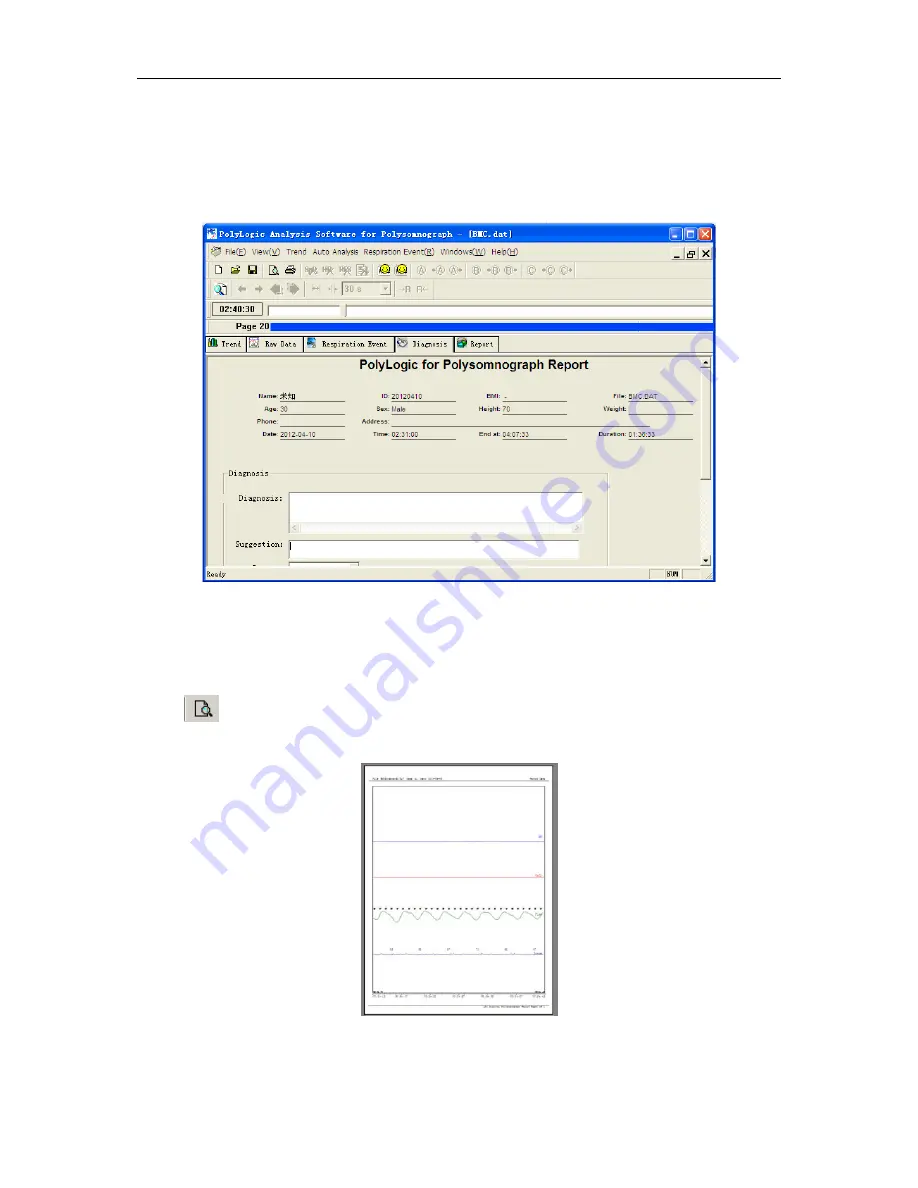 BMC Polymate YH-1000C User Manual Download Page 54