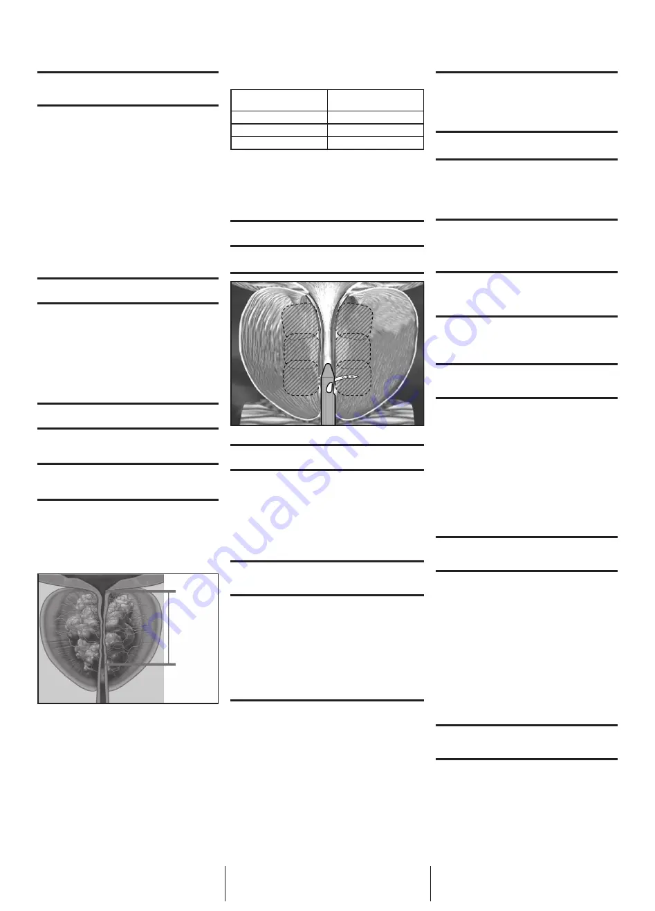 Boston Scientific rezum Series Скачать руководство пользователя страница 4