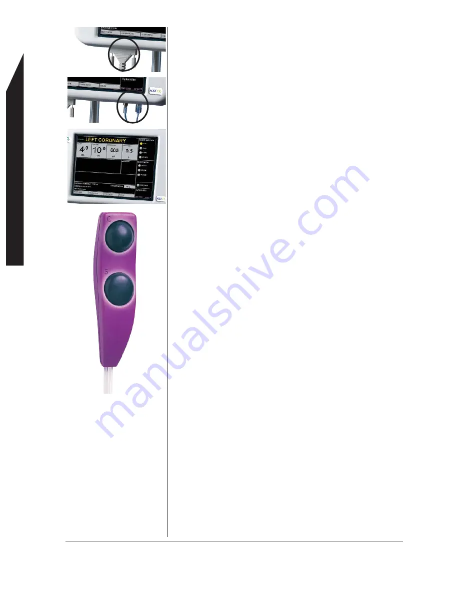 Bracco ACIST CVi CMS2000 User Manual Download Page 22