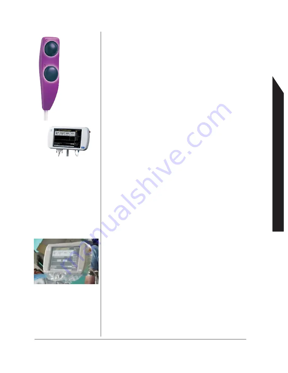 Bracco ACIST CVi CMS2000 User Manual Download Page 55