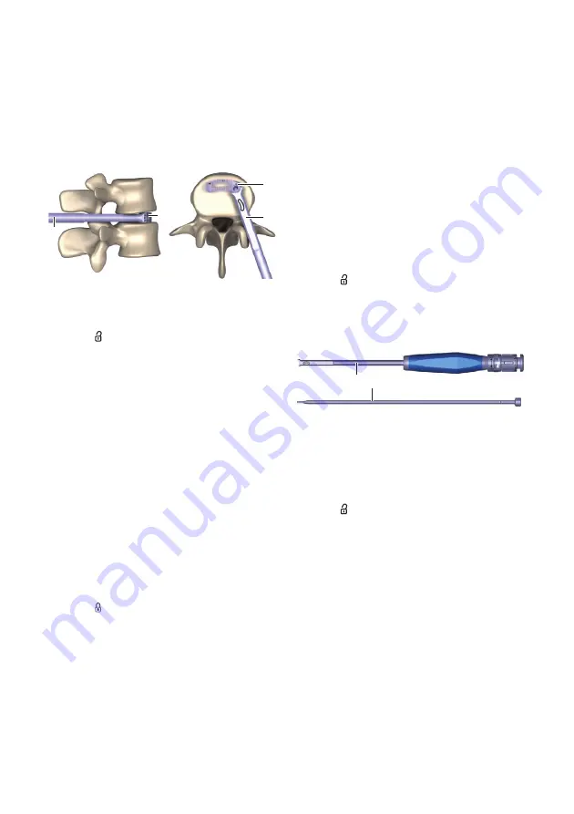 Braun Aesculap TSPACE PEEK Instructions For Use/Technical Description Download Page 171