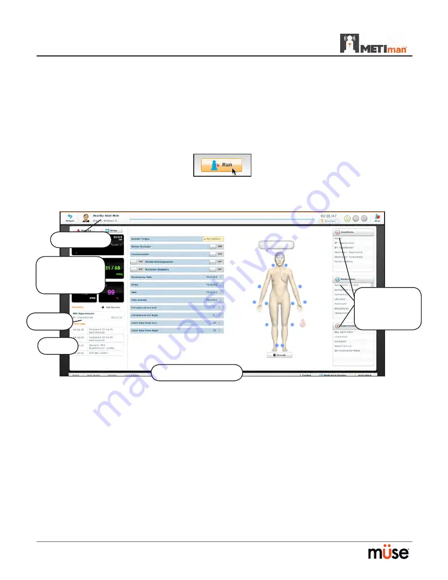 CAE Healthcare METIman Скачать руководство пользователя страница 74