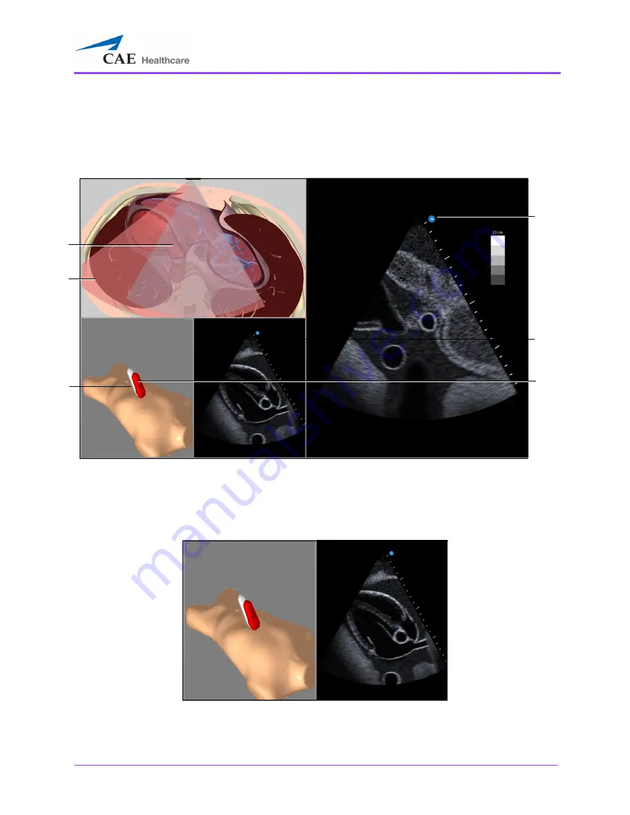 CAE Healthcare Vimedix Cardiac User Manual Download Page 89