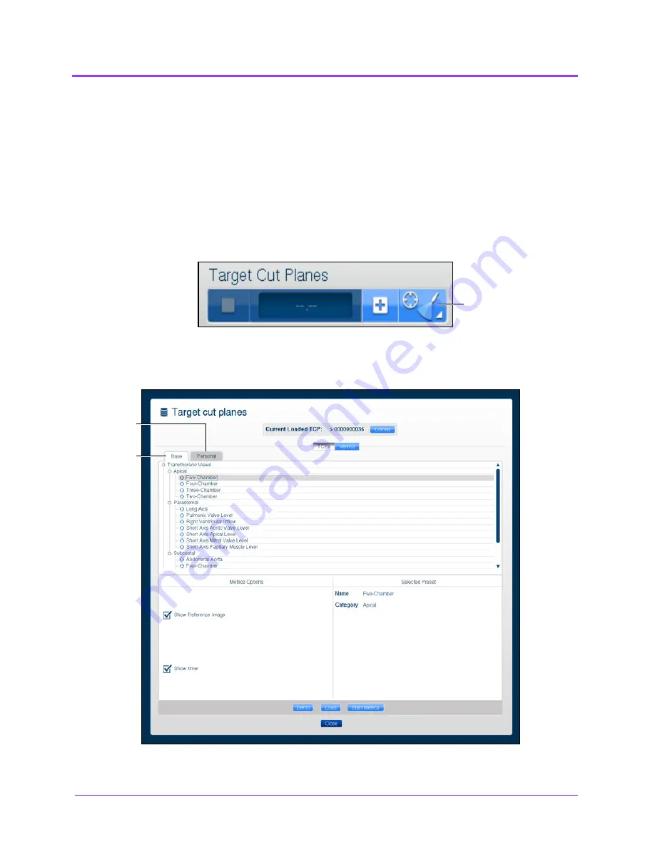 CAE Healthcare Vimedix Cardiac User Manual Download Page 94