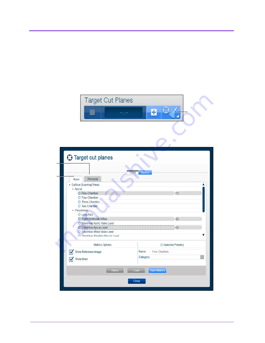 CAE Healthcare Vimedix Cardiac User Manual Download Page 96