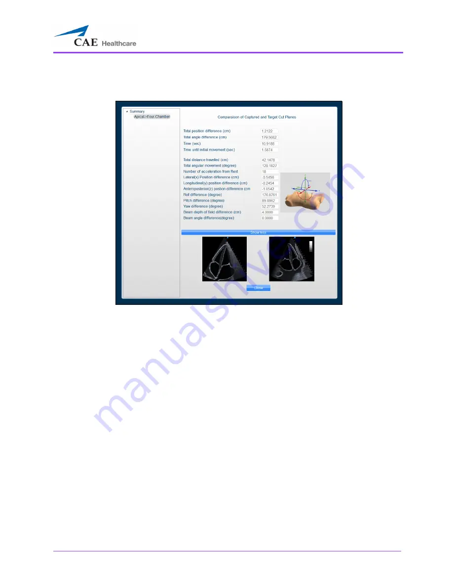 CAE Healthcare Vimedix Cardiac User Manual Download Page 101