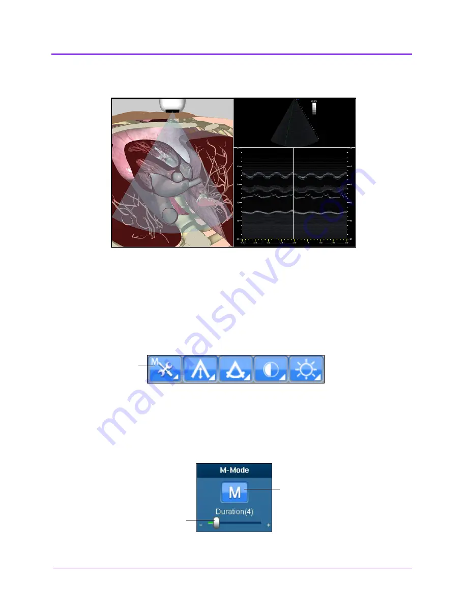 CAE Healthcare Vimedix Cardiac User Manual Download Page 156