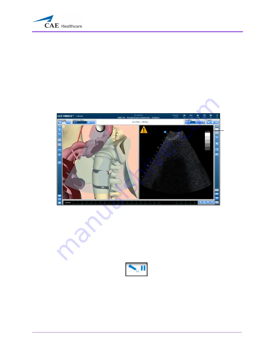 CAE Healthcare Vimedix Cardiac User Manual Download Page 205