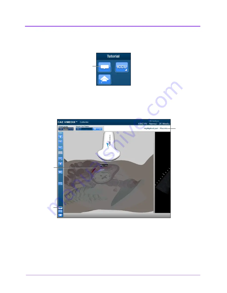 CAE Healthcare Vimedix Cardiac User Manual Download Page 246