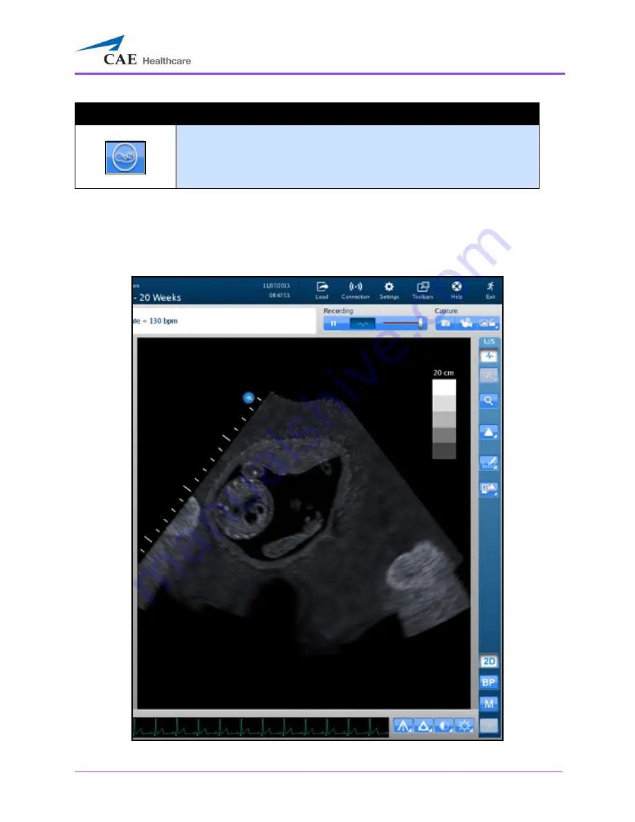 CAE Healthcare Vimedix Cardiac User Manual Download Page 319