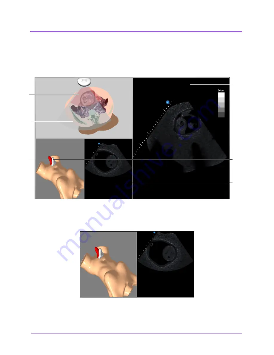 CAE Healthcare Vimedix Cardiac User Manual Download Page 342