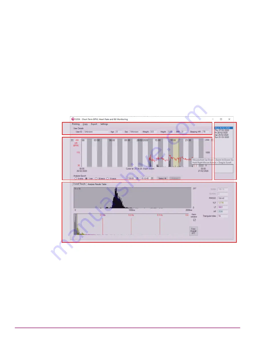 CamNtech The Actiheart User Manual Download Page 19