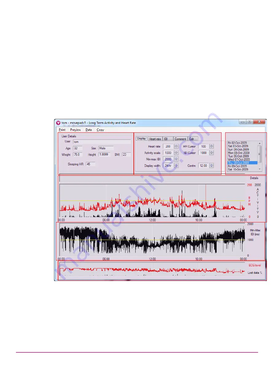 CamNtech The Actiheart User Manual Download Page 25