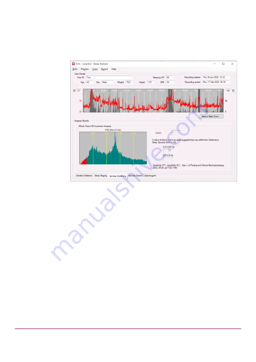 CamNtech The Actiheart User Manual Download Page 66