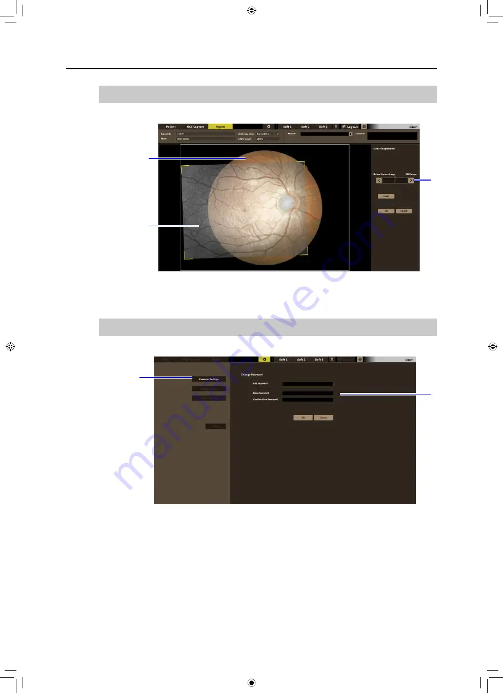 Canon OCT-A1 Operation Manual Download Page 45