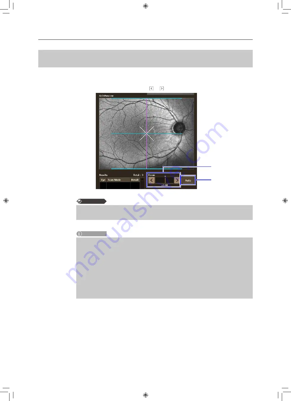 Canon OCT-A1 Operation Manual Download Page 98