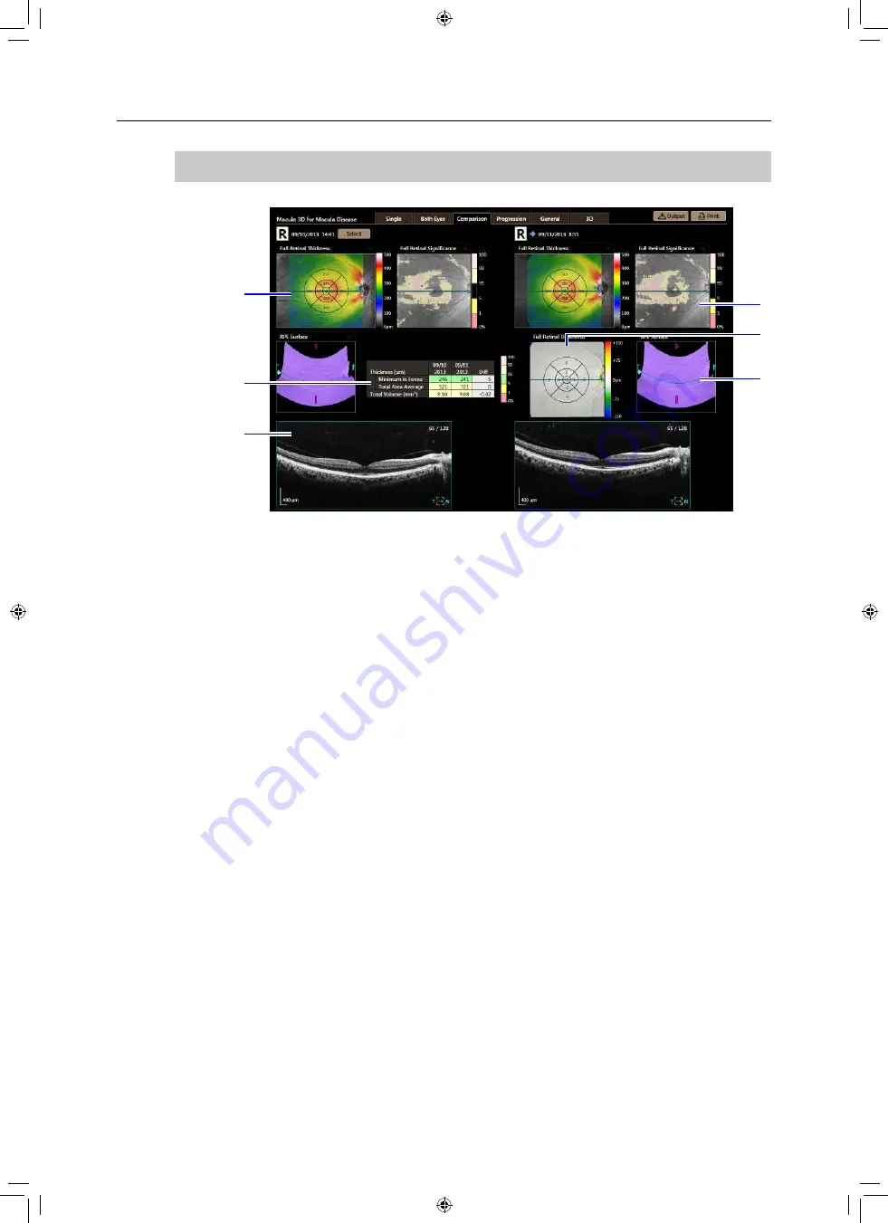 Canon OCT-A1 Operation Manual Download Page 118