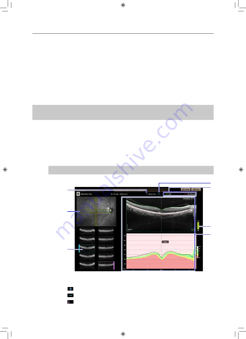 Canon OCT-A1 Operation Manual Download Page 135