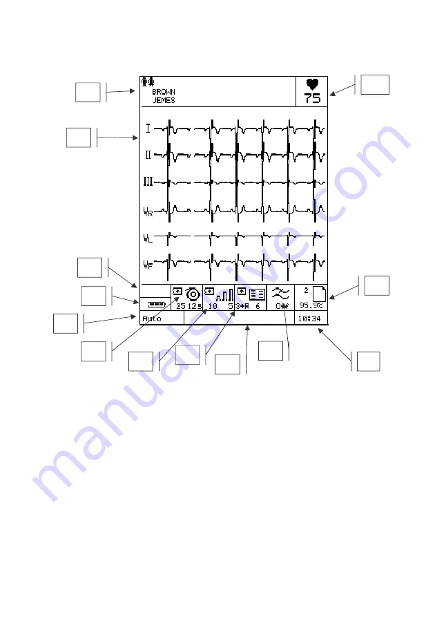 Cardioline ar1200view User Manual Download Page 13