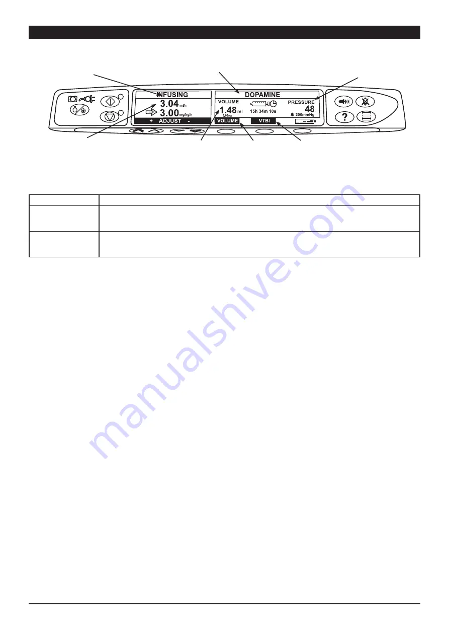 CareFusion Alaris CC User Manual Download Page 7