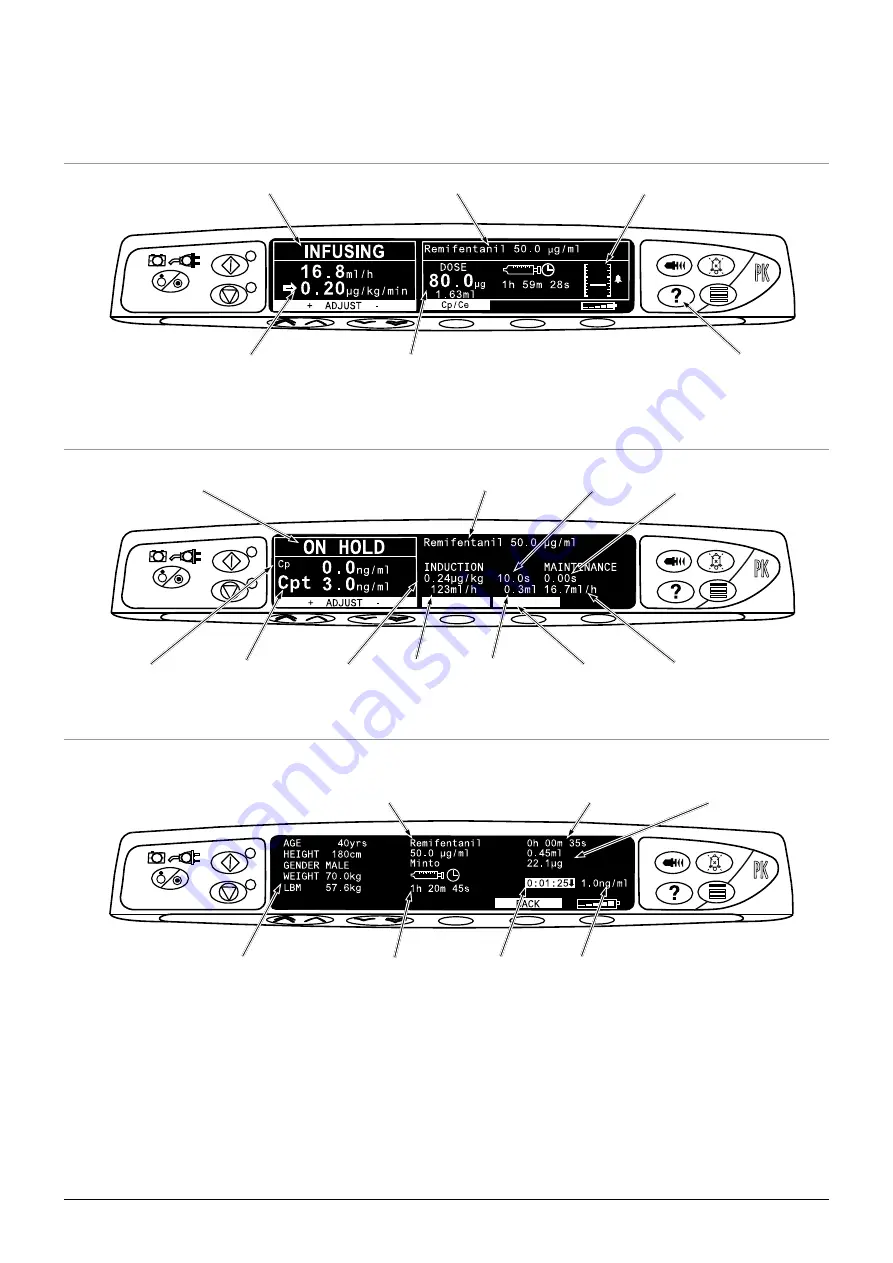 CareFusion Alaris PK Plus MK4 8005PK201 Directions For Use Manual Download Page 12