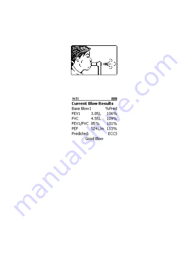 CareFusion Micro I Operating Manual Download Page 25